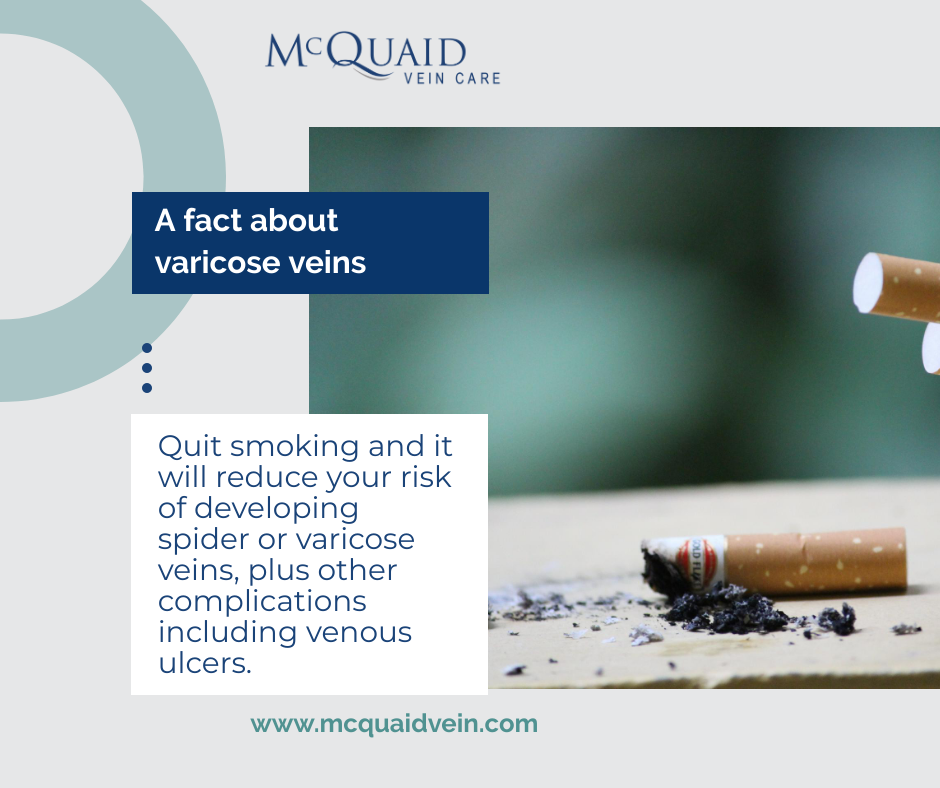 Conservative Measures for Vein Treatment